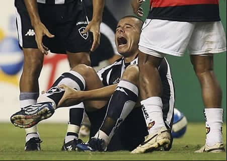 Luciano Almeida: el jugador del Botafogo sufrió una impactante fractura en la pierna derecha que lo marginó seis meses de las canchas.